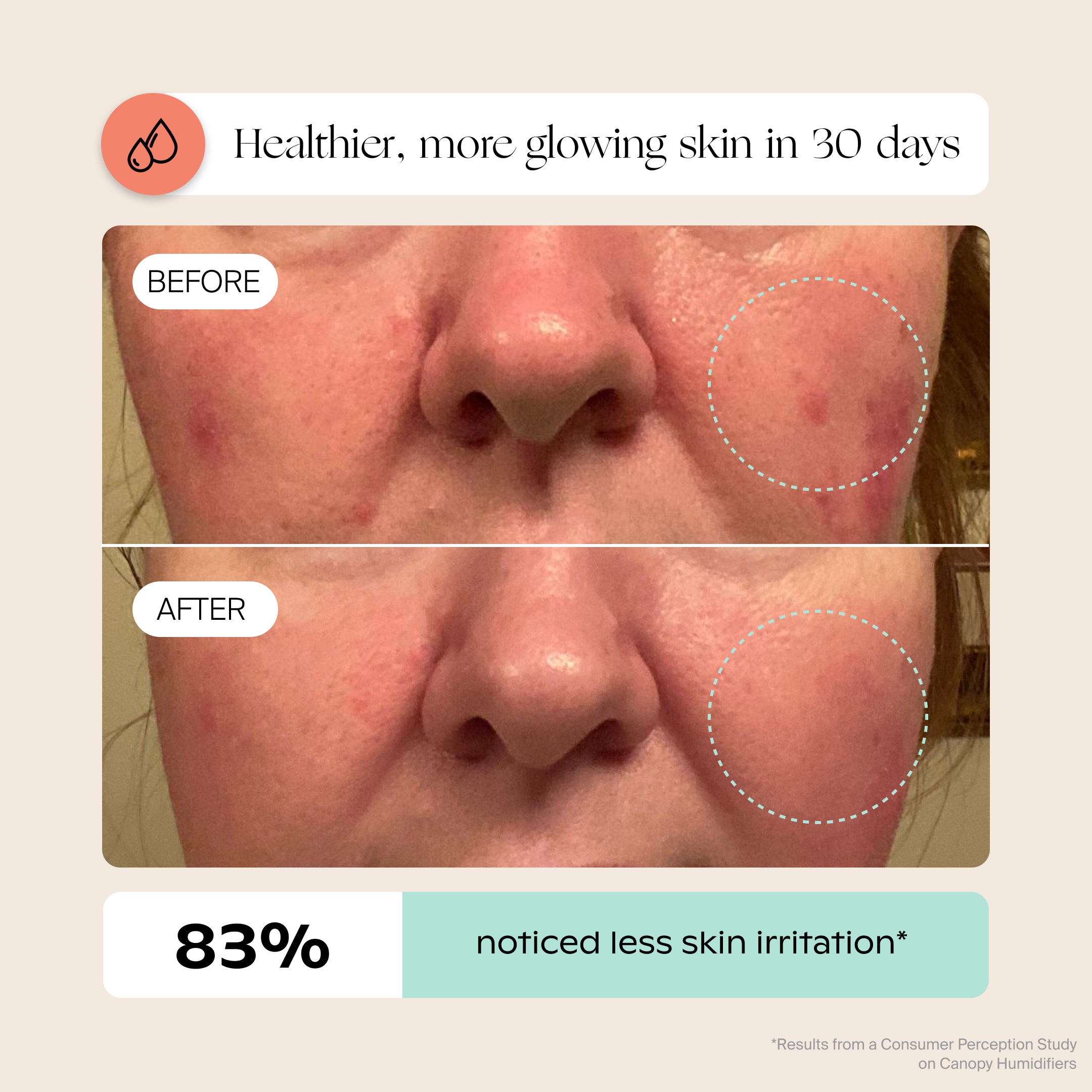 6.Humidifier2.0.jpg