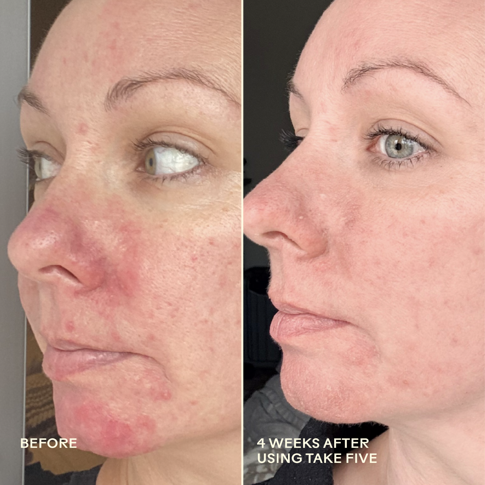990478500341_7_Before_After.png