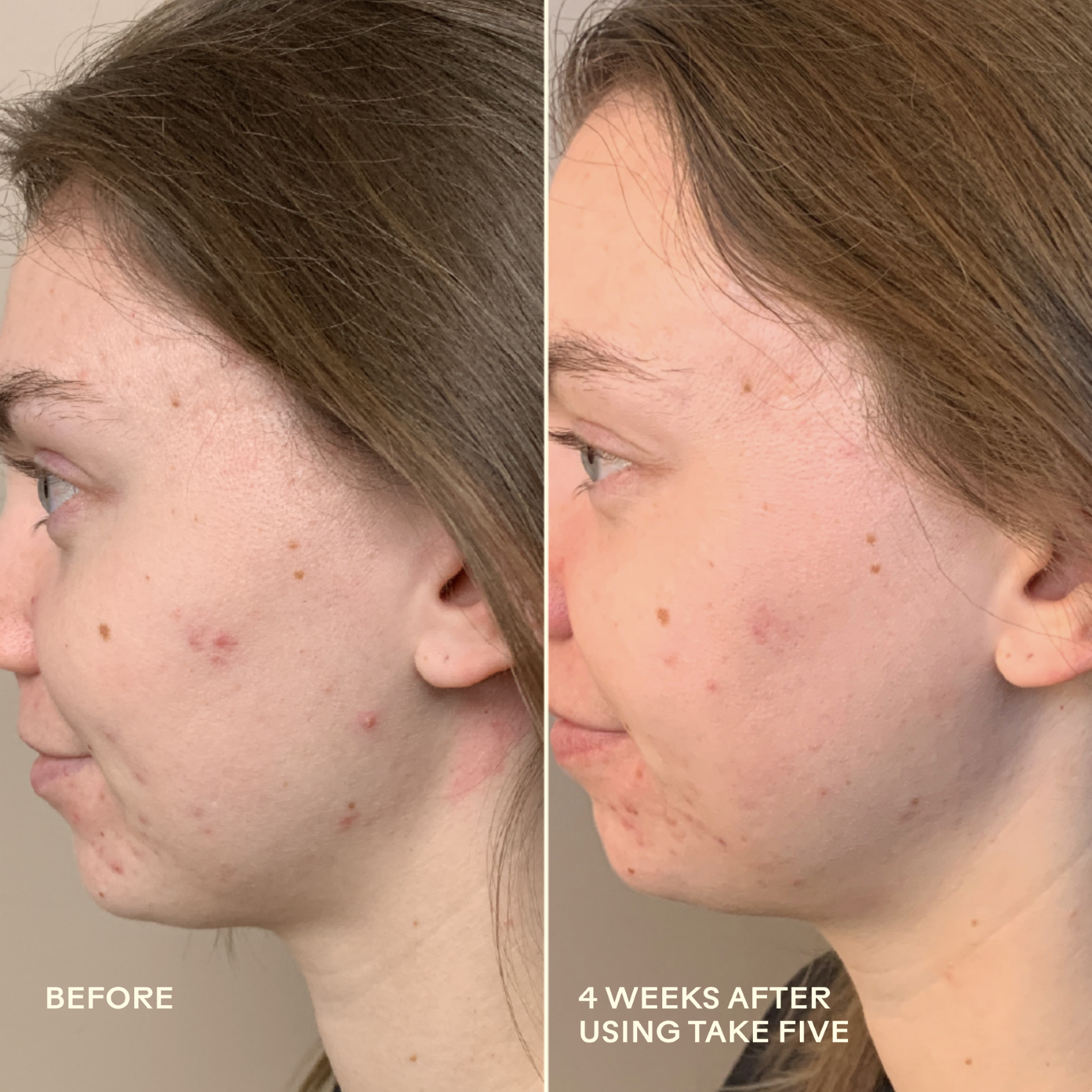 990478500341_8_Before_After.png