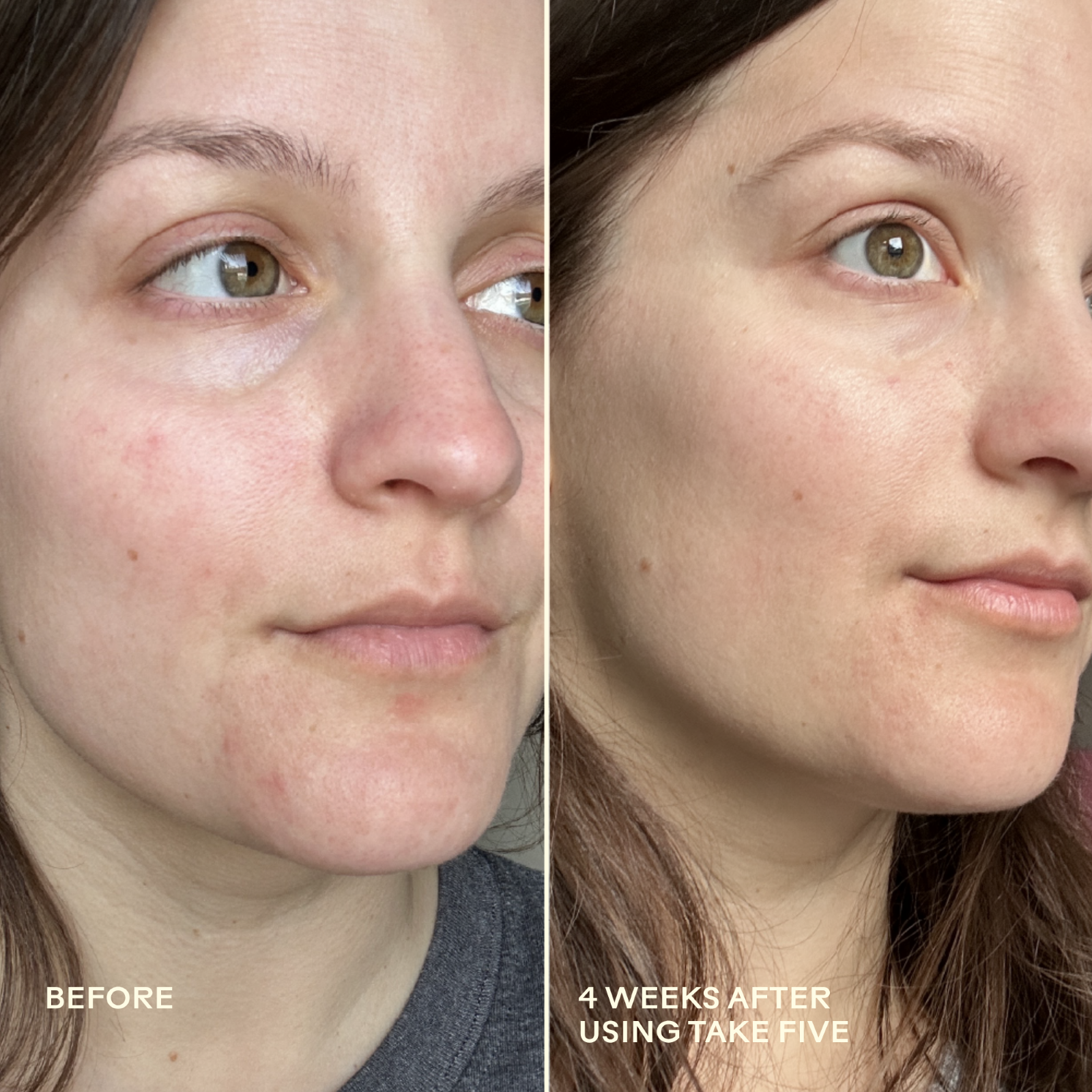 990478500341_9_Before_After.png