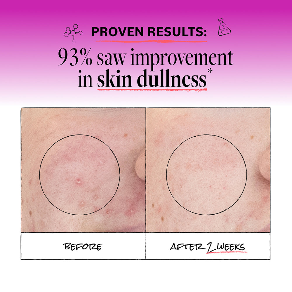 DERMAEMicrodermabrasionScrub_lifestyle3.jpg