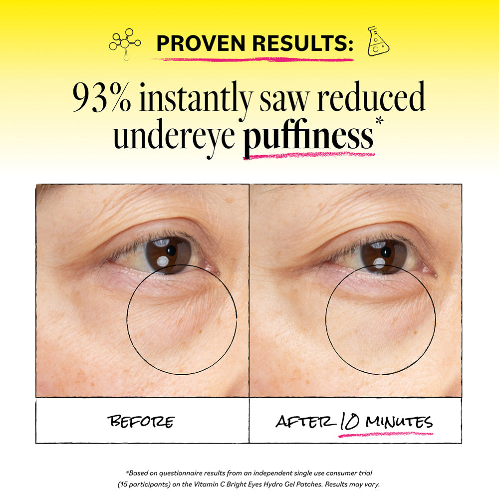 DERMAEVitaminCHydroGelPatches_lifestyle3.jpg