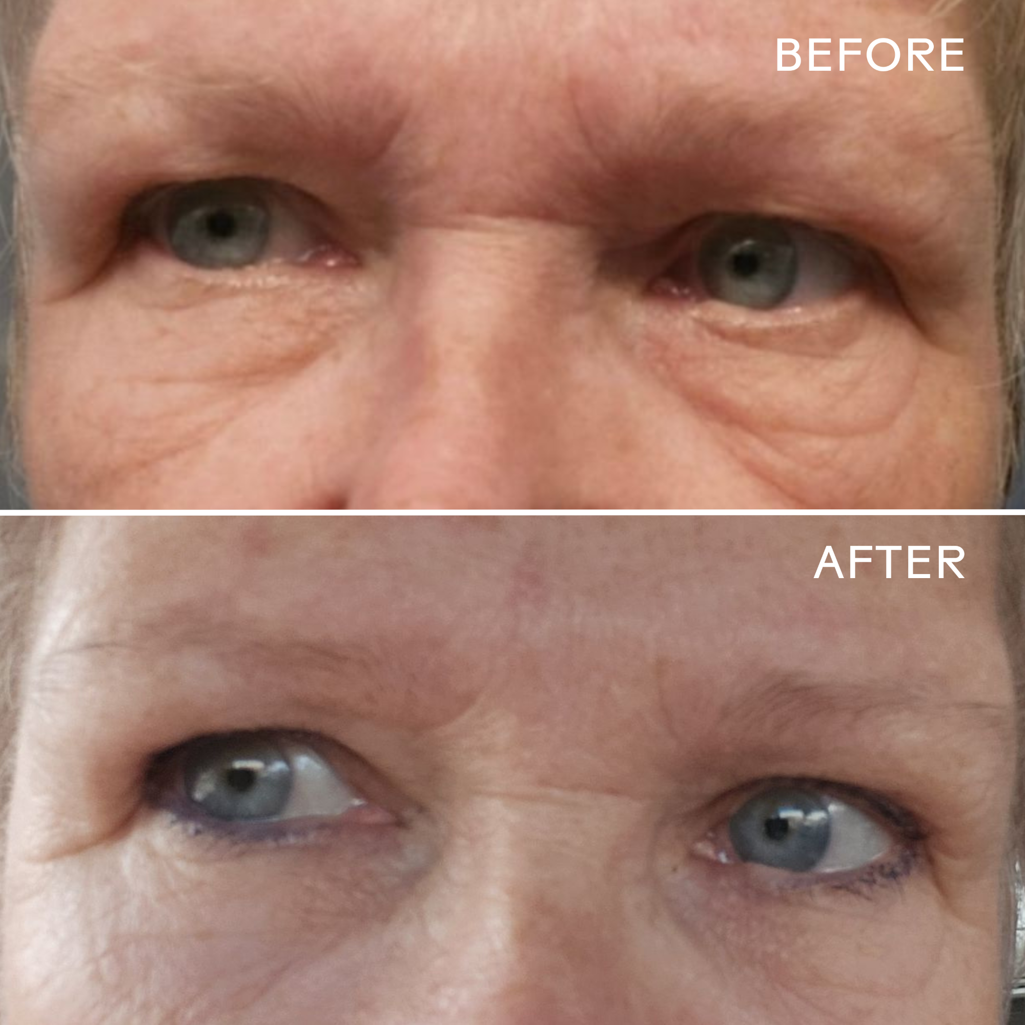 EyeHeroBio-RetinolSmoothingEyeCream_628110639530_B_A-3.png