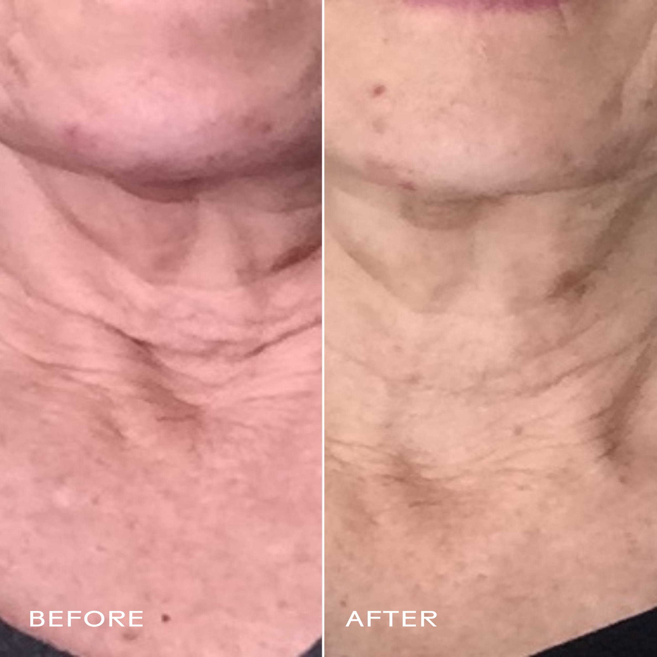 FirmBelieverGojiStemCell_PomegranateSmoothingNeck_FaceCream_628110639097_B_A.png
