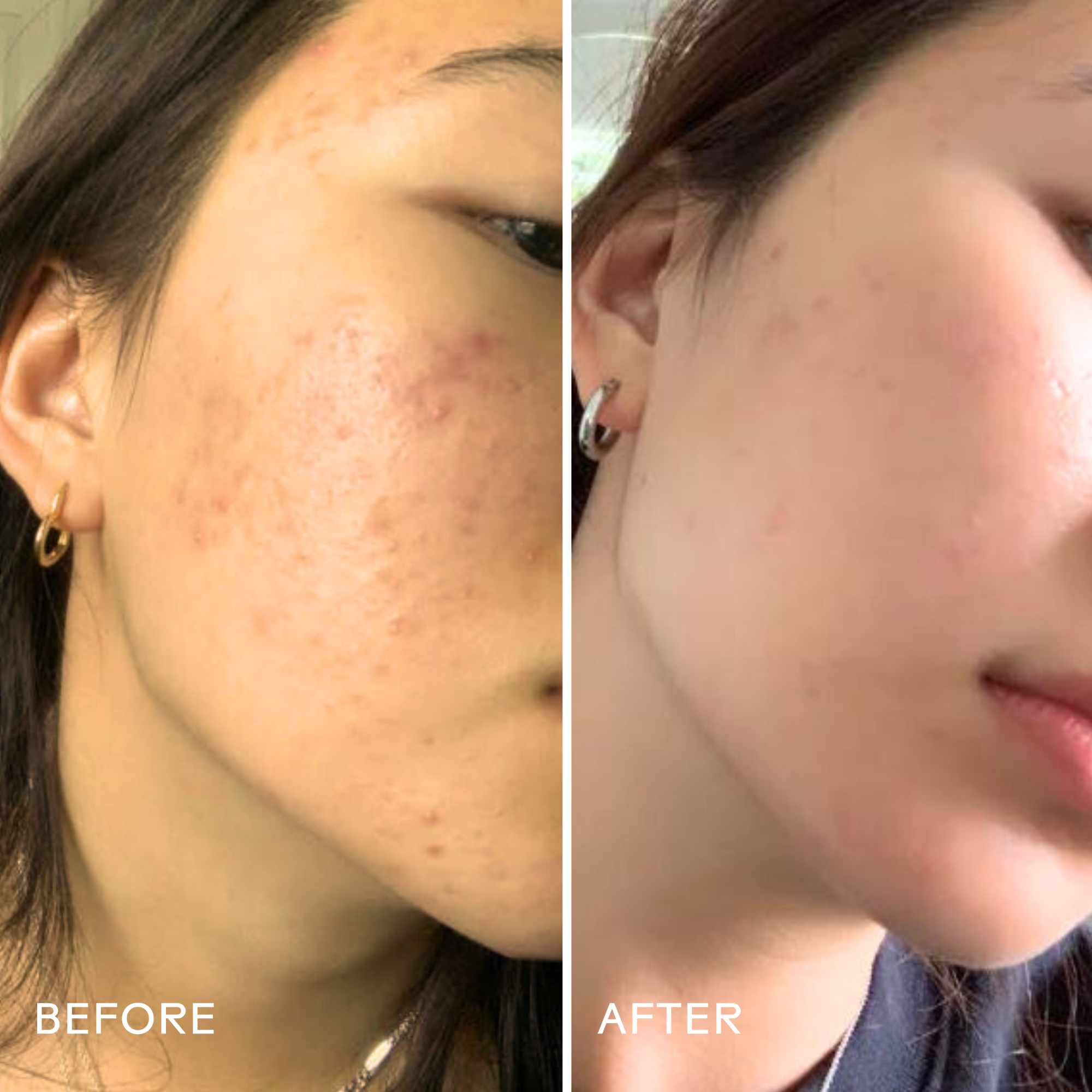 PurifyAloe_AminoAcidGelCleanser_628110639134_B_A.png